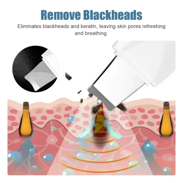 Deep Skin Scrubber — Gentle Vacuum Exfoliating Cleaner
