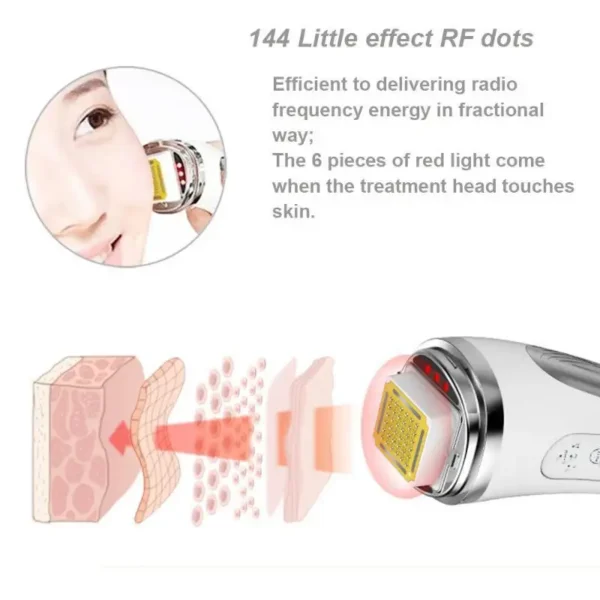 RF Radio Frequency Face Lifting Device – Dot Matrix Skin Tightening