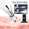 Portable Diamond Microdermabrasion Machine — Vacuum Exfoliating Peeler