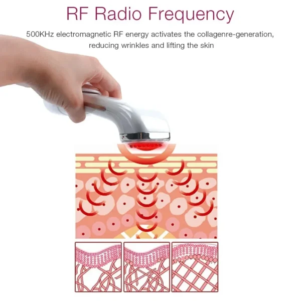 S80f9806b0e5b4d5585570bbca7d7a84fA.webp RF Beauty Device Radio Frequency Rechargeable Skin Tightening Machine Wrinkle Reduction Face