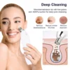 Portable Diamond Microdermabrasion Machine — Vacuum Exfoliating Peeler