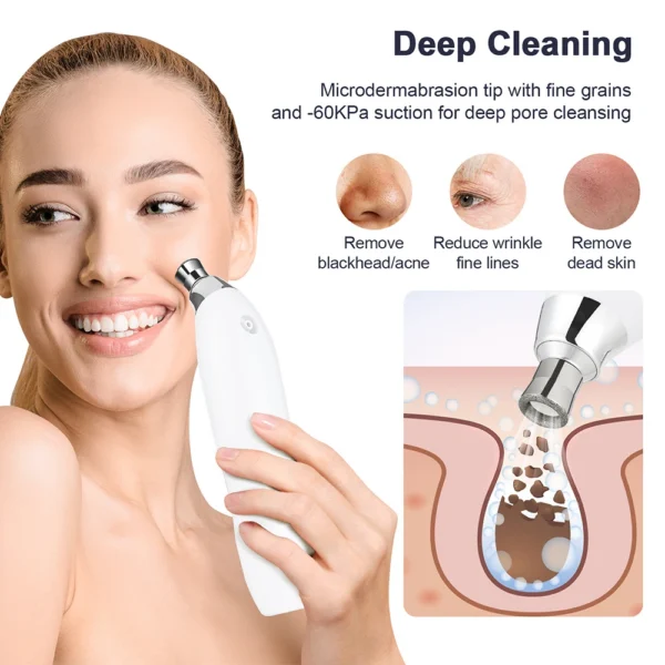Portable Diamond Microdermabrasion Machine — Vacuum Exfoliating Peeler