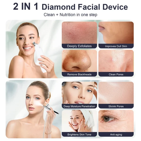 Portable Diamond Microdermabrasion Machine — Vacuum Exfoliating Peeler